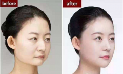 ���ͺ��ز�����¡��Ч�����ԾS�ֶ��?