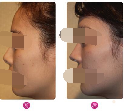 ���ͺ��ؼ��w¡�Ƕ����X