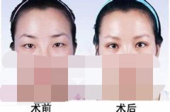 ���ͺ����p��Ƥ�ļ��t(y��)ԺЧ������