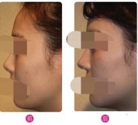 ���ͺ��ؼ��w¡�Ƕ����X?