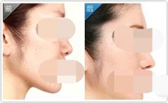 ���ͺ������wܛ��¡�Ƕ����X?