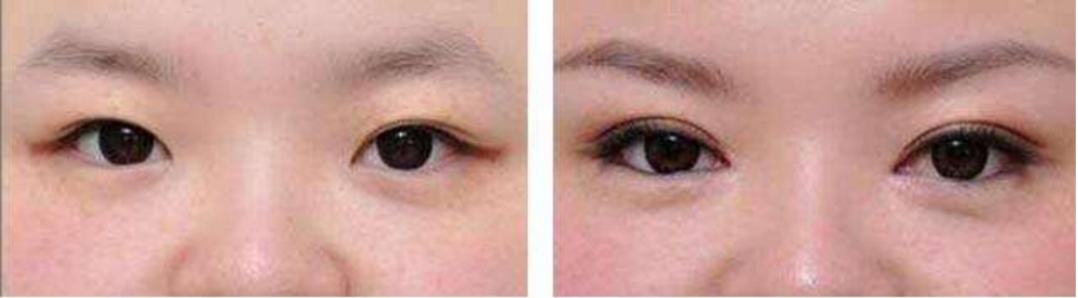 �����p��Ƥ