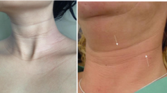 ���ͺ����i�����F(xi��n)���y��ôȥ��?