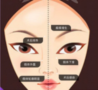 ���ͺ�������¡��ʧ����ô�k����