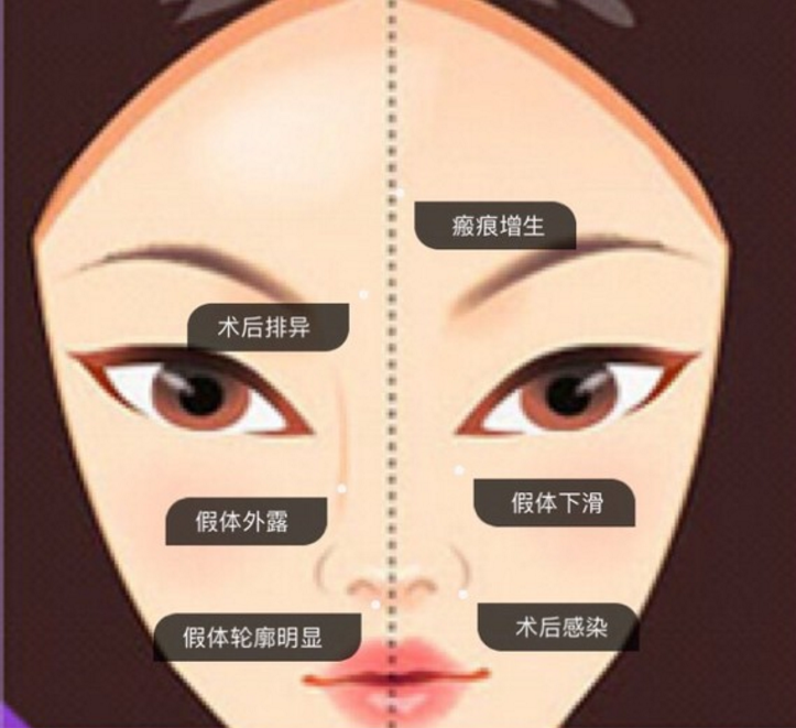 呼和浩特整形隆鼻