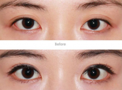 ���ͺ��������_�۽��g(sh��)����ע�������