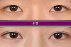 �����_�۽Ǻ��܉�׌�۾��@�ø����������