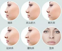 ���ͺ���¡�Ǻ������ͨ����ô�k��