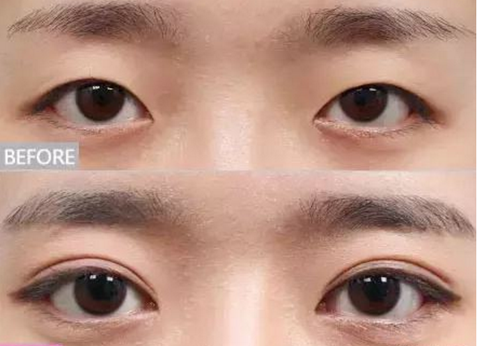 ���ͺ��������p��Ƥ