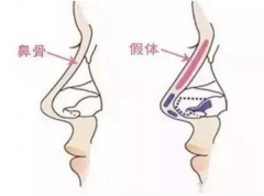 ���ͺ�������Ӱ푼��w¡��Ч����������ʲô��