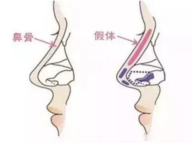 ���ͺ�������¡��