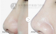 ���ͺ�������ע��¡�ǰ�ȫ����