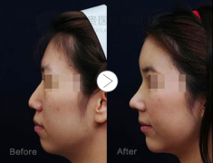 ���ͺ���ʲô�Ǽ��w¡������