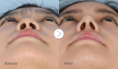 ���ͺ���������¡�����g(sh��)��ʲô�����^����