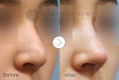 ���ͺ������ι��z¡�ǵ�Ч�����Ա��ֶ����