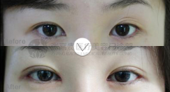 ���ͺ�������������߀�ܸ��p��Ƥ����