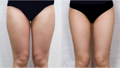 �����Ȳ���֬���g(sh��)��Ҫ�����X(qi��n)��