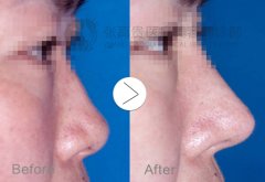 ���ͺ������α���������Ч�ķ�����ʲô��