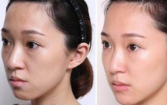 �������w֬������۸CЧ����ô����