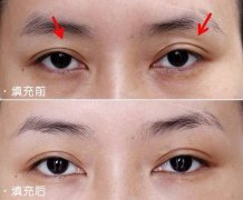 ���ͺ��������۸C������ô�ޏ�(f��)������