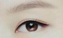 ���ͺ�����������ͫ����Ҫע��ʲô?