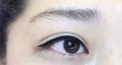 ����������ͫ�����۾��ą^(q��)�e����Щ��