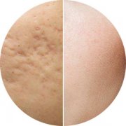 �ӡ���̶���ʲô�����أ�