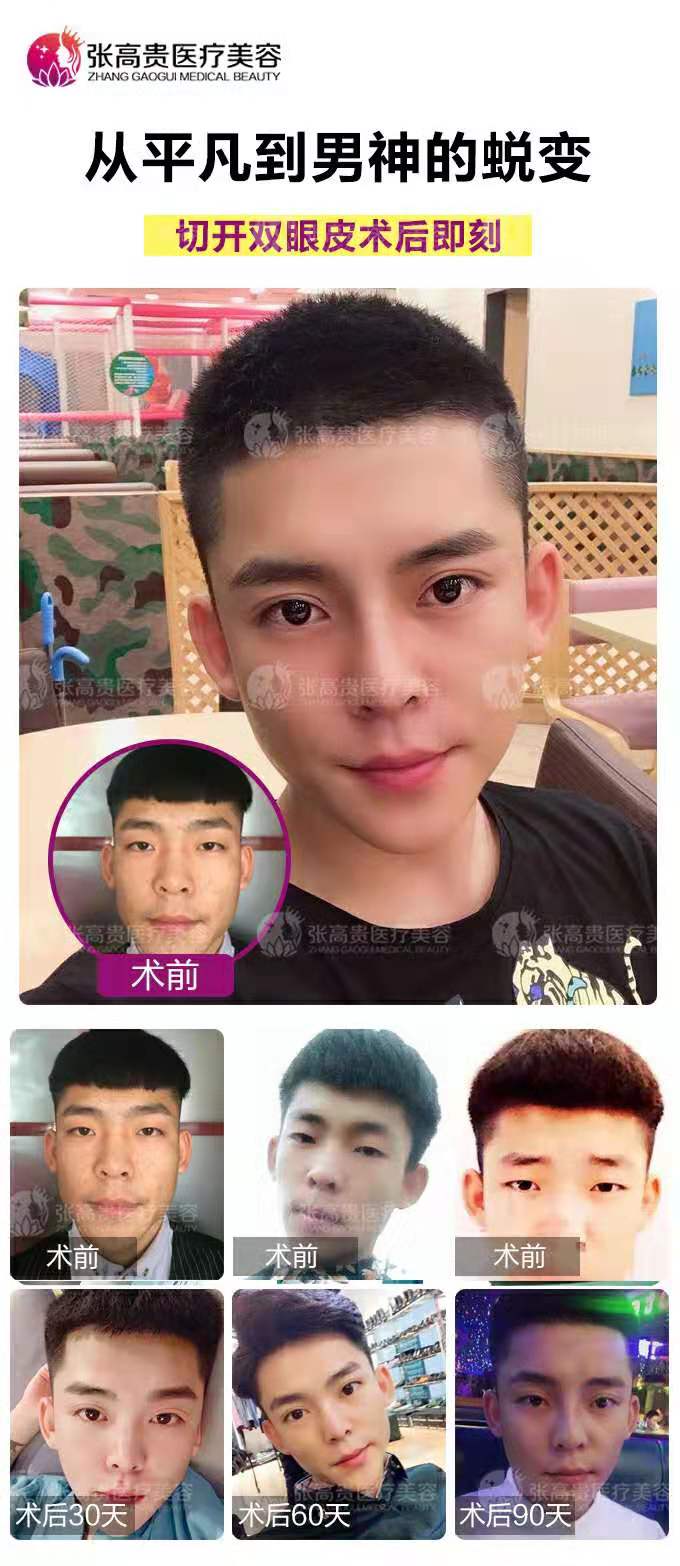 ΢�ňDƬ_20191011085049