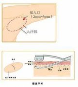 ���ͺ�����ע��botox��Ҹ��������ȫ?