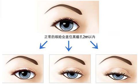 ���������p��Ƥ