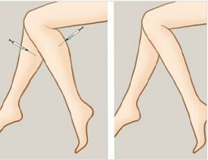 呼和浩特整形醫(yī)院