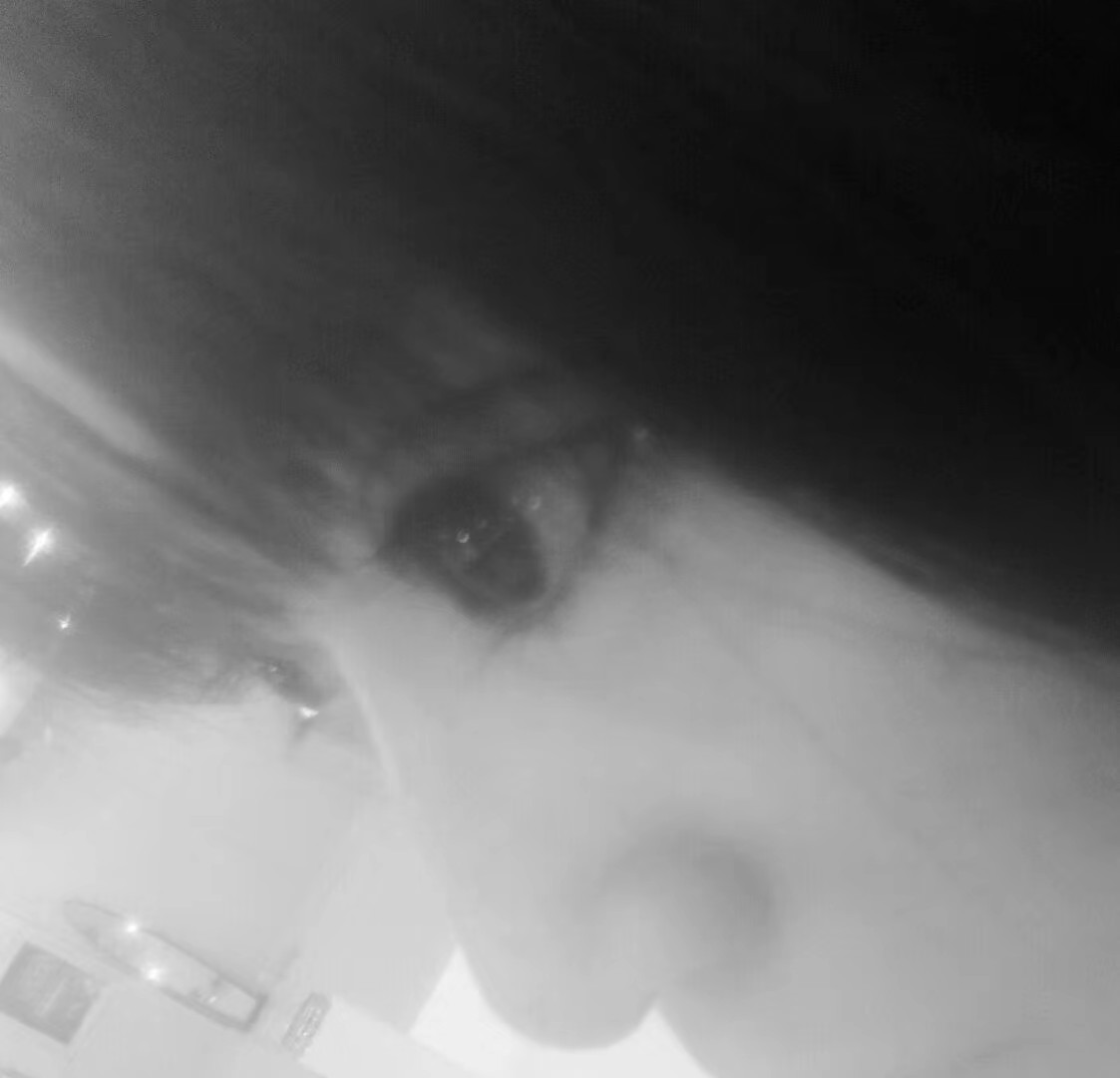 �����p��Ƥ�����t(y��)Ժ