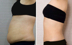 ��������֬Σ�U��?