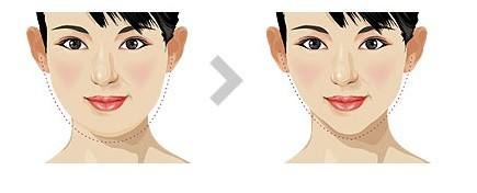 ���ͺ�������