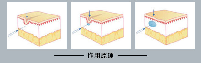 ���ͺ�������