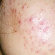 Ę�������Ч���ò���?