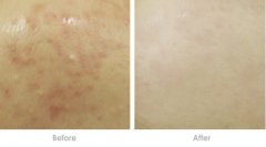 ��Щ�����ܽ�QƤ�w�ֲ���?