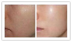 �����ί�Ƥ�w�ֲڕ�(hu��)����(hu��)�и�������?