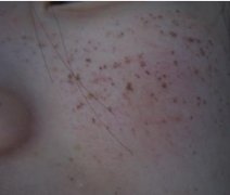 ����ʹ�ֲڵ�Ƥ�w׃�ü�(x��)ā��?