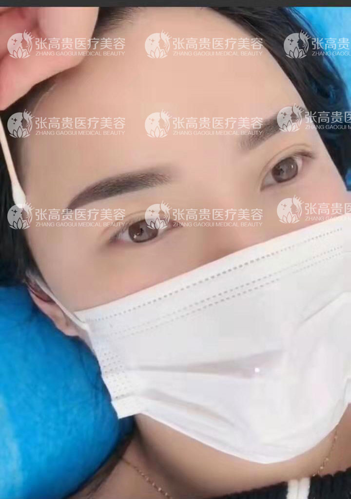 呼市張高貴整形