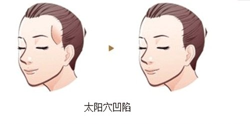 ���ͺ�������