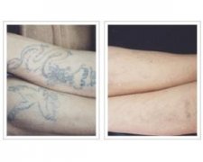 ����ϴ�y�������Ч���᣿