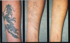 ��Щ����ϴ�y��Ч������