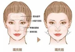 �°����Ε���Σ�U����