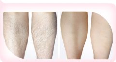 ������֬���gЧ���ò�����