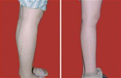 �Ȳ���֬���g�������и������أ�