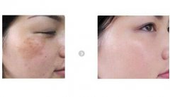 �ɲ�����ȥ�����g(sh��)�̺�����