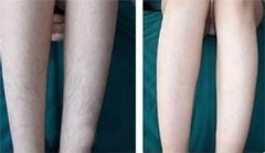 ���ͺ�����ע�������Ч�����L�r�g�֏���Ȼ�أ�