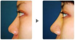 ���б������õ����N���η����Ď׷N��