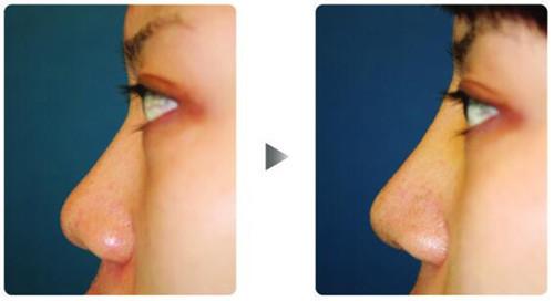 �����ߵ�